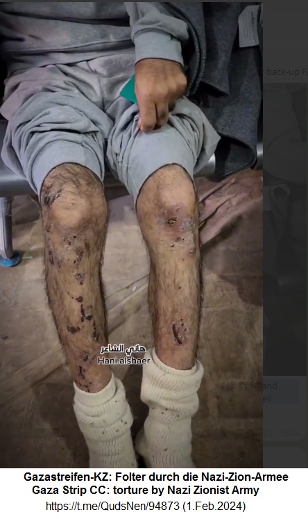 Gazastreifen-KZ
                      irgendwo am 1.2.2024 - 16:44h: Ein von der
                      Nazi-Zion-Armee gefolterter Pal�stinenser zeigt
                      seine verletzten Beine - FOLTER+KRIEGSVERBRECHEN