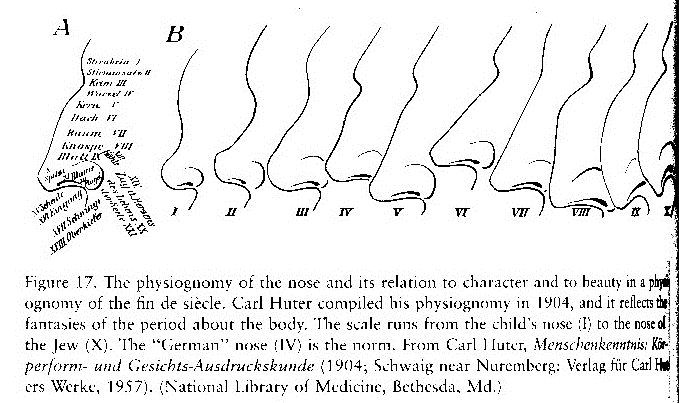 J�dische Nase mit heruntergezogener
                        Nasenspitze, Schema