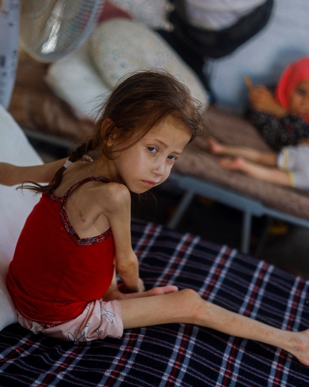 Killer-Israel spielt
                  "Leningrad" mit dem Gazastreifen-KZ
                  25.6.2025 - 8:31h: 18.741 Kinder unterern�hrt
                  gemeldet